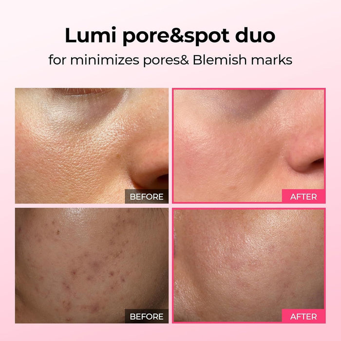 Dr.Melaxin Cemenrete Lumi Pore & Spot Duo - Spicule-Infused Skin Renewal Set