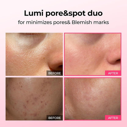 Dr.Melaxin Cemenrete Lumi Pore & Spot Duo - Spicule-Infused Skin Renewal Set
