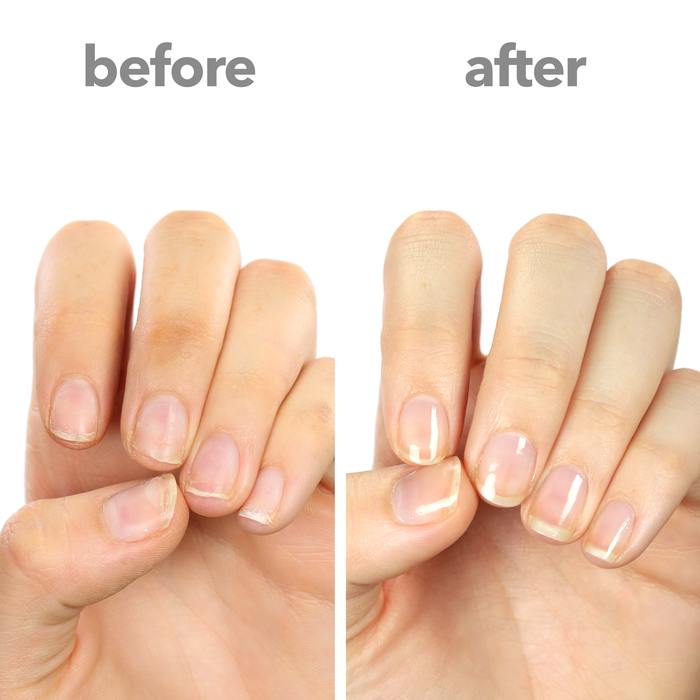 First Aid Kiss nail strengthener before and after on bare natural nails