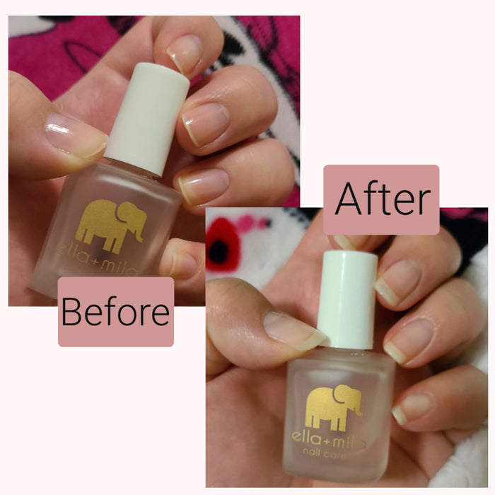 First Aid Kiss customer before and after results, holding the bottle