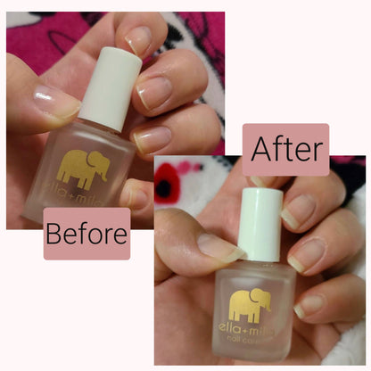 First Aid Kiss customer before and after results, holding the bottle