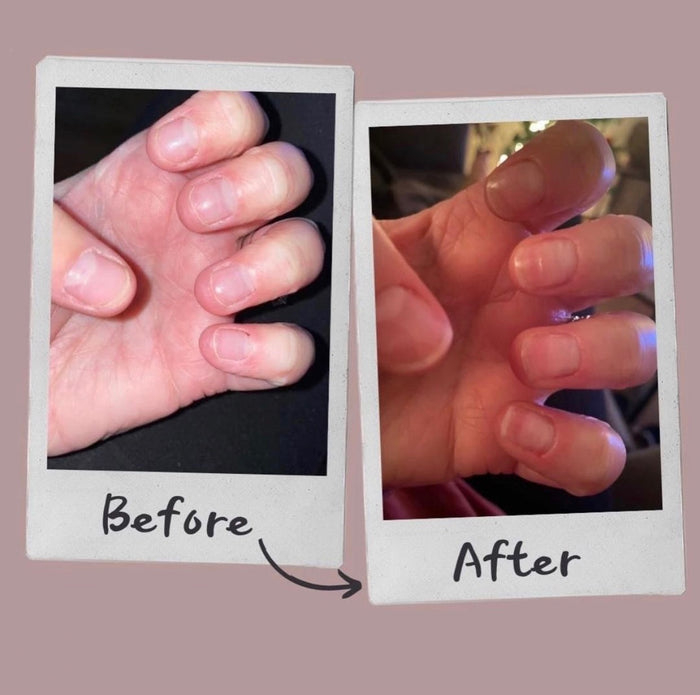 First Aid Kiss before and after photos of strengthened natural nails