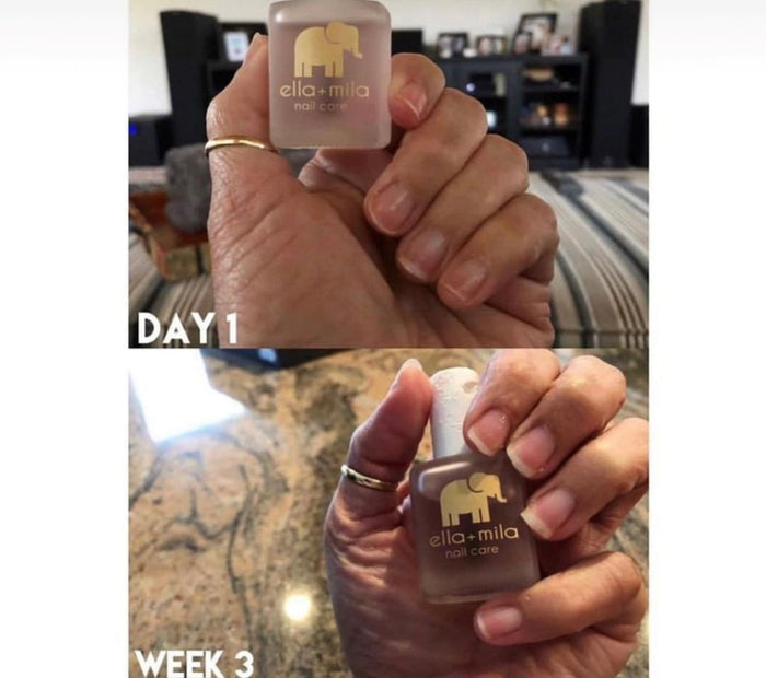 First Aid Kiss nail growth progress from day 1 to week 3