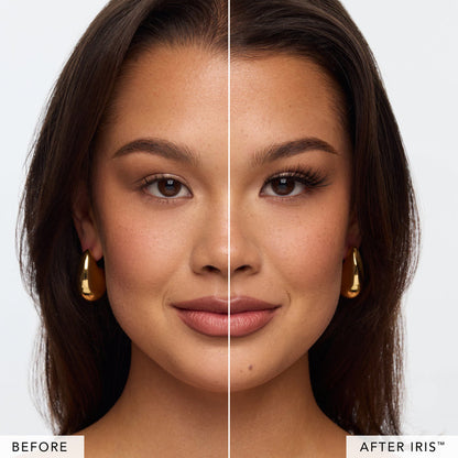 Split-screen portrait comparing before and after Iris results on a woman's face