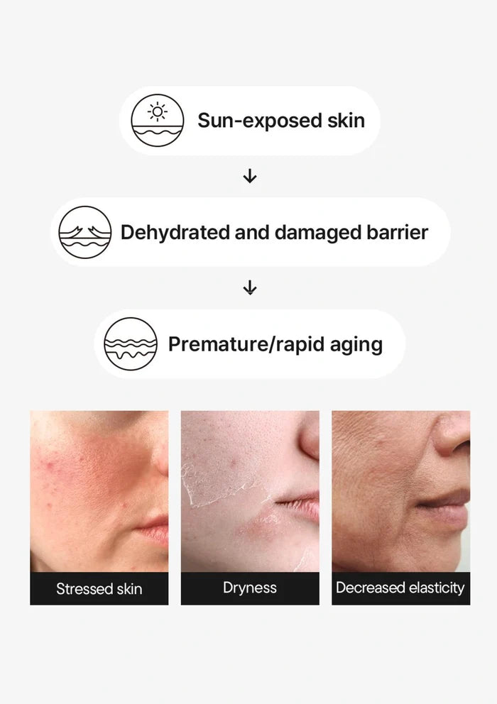 Diagram showing the effects of sun exposure on skin health with images of stressed, dry, and aged skin.