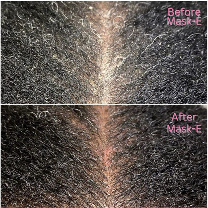 Kurlee Belle Mask E Scalp Detox